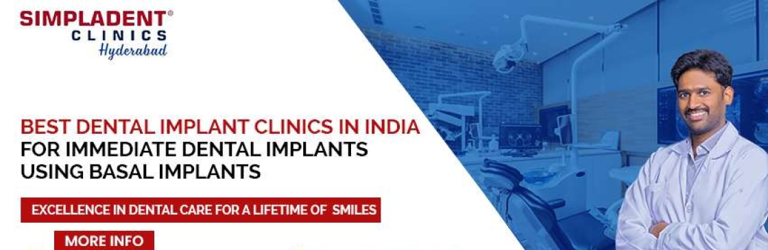 Full Mouth Dental Implant in Hyderabad Cover Image