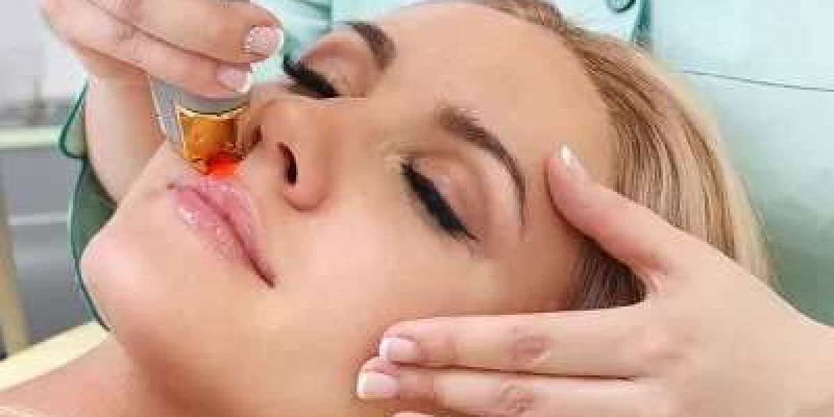 Laser Hair Removal in Islamabad: A Modern Solution for Smooth, Hair-Free Skin