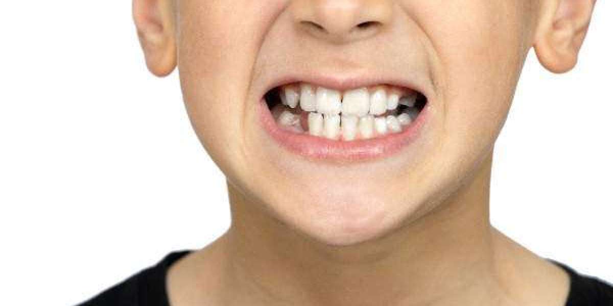 How to Prevent Dental Injuries During Sports or Travel